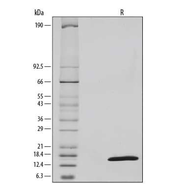 Recombinant Human TSLP Protein SDS-PAGE