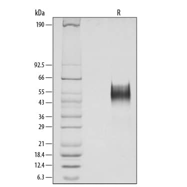 Recombinant Human Thrombopoietin Protein SDS-PAGE