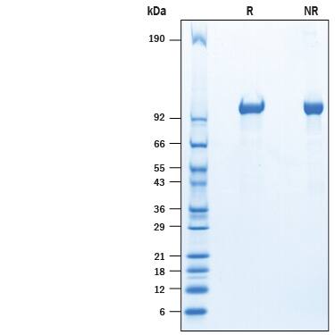 Recombinant Mouse Tie-2 His-tag Protein SDS-PAGE