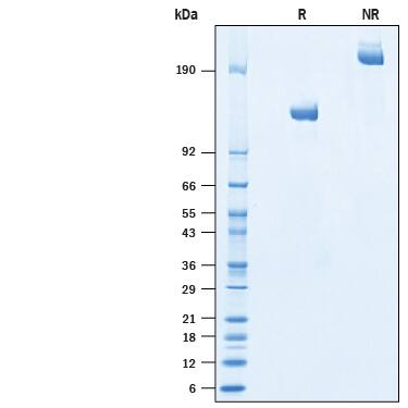 Recombinant Porcine Tie-2 Fc Chimera Protein SDS-PAGE