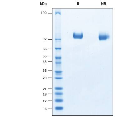 Recombinant Porcine Tie-2 His-tag Protein SDS-PAGE
