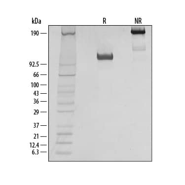 Recombinant Human TrkB Fc Chimera Protein SDS-PAGE