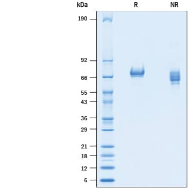 Recombinant Mouse Tyro3/Dtk His-tag Protein SDS-PAGE