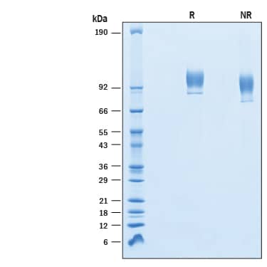 Recombinant Human VCAM-1/CD106 His-tag Protein SDS-PAGE