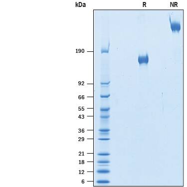 Recombinant Human VEGFR2/KDR/Flk-1 Fc Avi-tag Protein SDS-PAGE