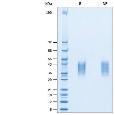Recombinant Cynomolgus VISTA/B7-H5/PD-1H His-tag Protein SDS-PAGE