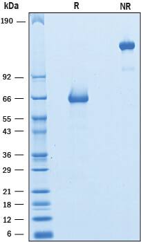Recombinant Rat VISTA/B7-H5/PD-1H Fc Chimera Protein SDS-PAGE