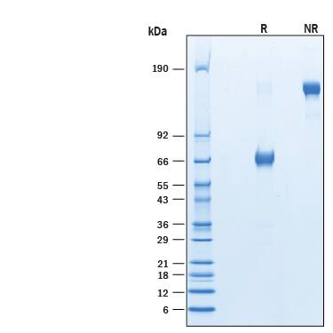 Recombinant Human VISTA/B7-H5/PD-1H Fc Avi-tag Protein SDS-PAGE