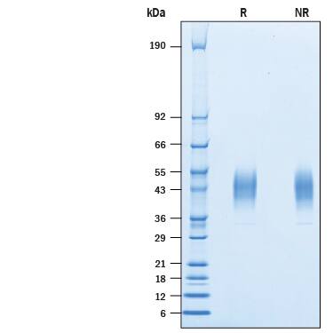 Recombinant Human VISTA/B7-H5/PD-1H His Avi-tag Protein SDS-PAGE