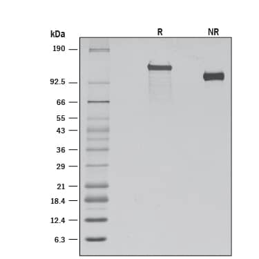 Recombinant Human VLDLR Protein SDS-PAGE