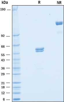 Recombinant Human VSIG2 Fc Chimera Protein SDS-PAGE