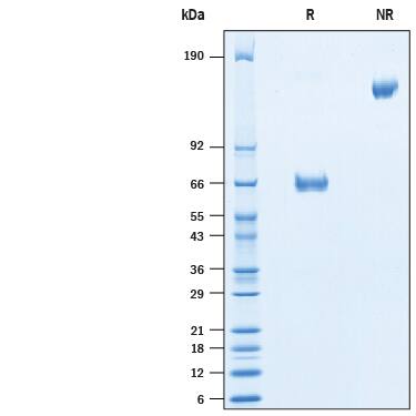 Recombinant Human VSIG3 Fc Chimera Avi-tag Protein SDS-PAGE