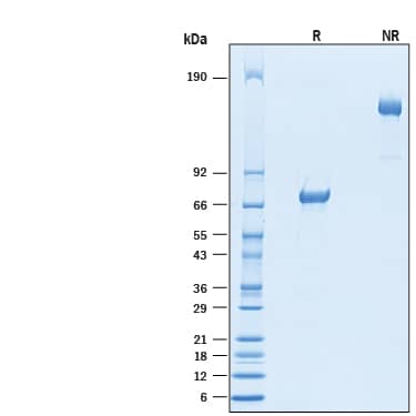 Recombinant Cynomolgus Monkey VSIG4 Fc Chimera Protein SDS-PAGE