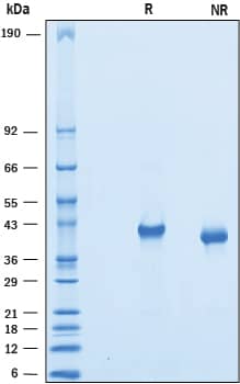 Recombinant Mouse VSTM2A His-tag Protein SDS-PAGE