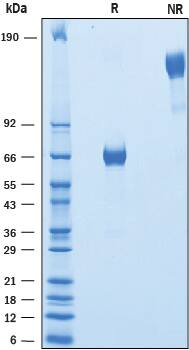 Recombinant Human VSTM2B Fc Chimera Protein SDS-PAGE