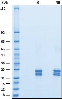 Recombinant Human VSTM2L HA-tag Protein SDS-PAGE