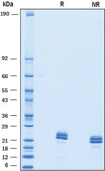 Recombinant Mouse VSTM2L HA-tag Protein SDS-PAGE