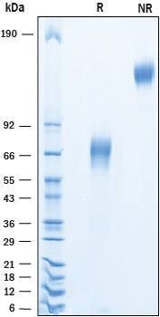 Recombinant Human VSTM4 Fc Chimera Protein SDS-PAGE