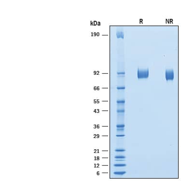 Recombinant Human Vasorin/SLIT-like 2 His-tag Protein SDS-PAGE