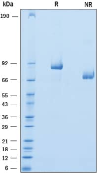 Recombinant Human Versican Isoform V3 His-tag Protein SDS-PAGE