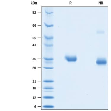 Recombinant SARS-CoV-2 Spike RBD His Biotin Protein SDS-PAGE