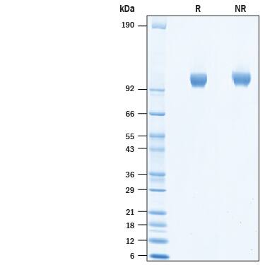 Recombinant Human ACE-2 His-tag Biotinylated Protein SDS-PAGE