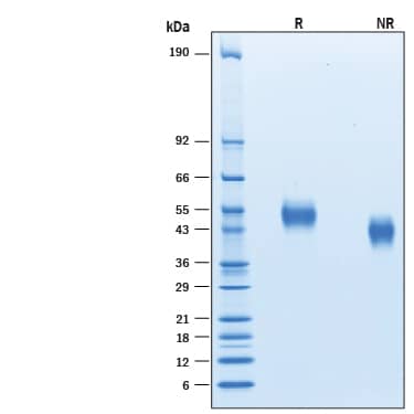 Recombinant Human uPAR His-tag Avi-tag Protein SDS-PAGE