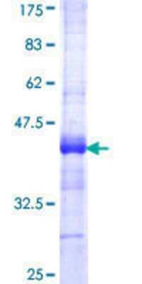 SDS-PAGE: Recombinant Human Acetyl-CoA Carboxylase alpha/ACACA GST (N-Term) Protein [H00000031-Q01]