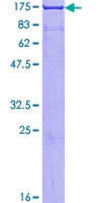 SDS-PAGE: Recombinant Human Amphiphysin/AMPH GST (N-Term) Protein [H00000273-P01]