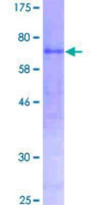 SDS-PAGE: Recombinant Human Pancreatic Amylase Alpha GST (N-Term) Protein [H00000279-P01]