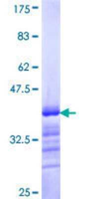 SDS-PAGE: Recombinant Human BACH1 GST (N-Term) Protein [H00000571-Q01]