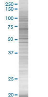 Other: Serpin G1/C1 Inhibitor 293T Cell Transient Overexpression Lysate [H00000710-T01]