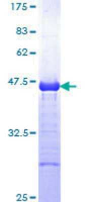 SDS-PAGE: Recombinant Human CBL GST (N-Term) Protein [H00000867-Q01]