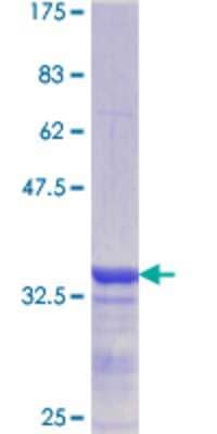 SDS-PAGE: Recombinant Human CBS GST (N-Term) Protein [H00000875-Q03]