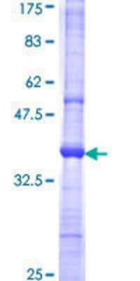 SDS-PAGE: Recombinant Human CD1c/BDCA-1 GST (N-Term) Protein [H00000911-Q01]