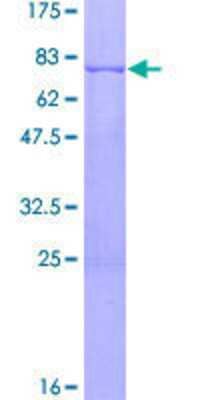 SDS-PAGE: Recombinant Human Septin-7 GST (N-Term) Protein [H00000989-P01]