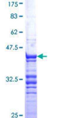 SDS-PAGE: Recombinant Human Cdc20 GST (N-Term) Protein [H00000991-Q01]