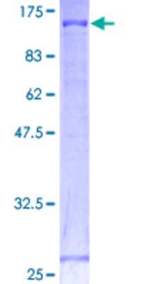 SDS-PAGE: Recombinant Human Cadherin-18 GST (N-Term) Protein [H00001016-P01]