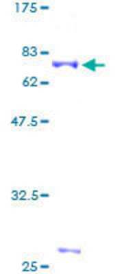 SDS-PAGE: Recombinant Human Cdk9 GST (N-Term) Protein [H00001025-P01]