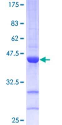 SDS-PAGE: Recombinant Human p19 INK4d GST (N-Term) Protein [H00001032-P01]