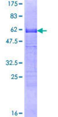 SDS-PAGE: Recombinant Human CDX2 GST (N-Term) Protein [H00001045-P01]