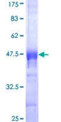 SDS-PAGE: Recombinant Human CDX4 GST (N-Term) Protein [H00001046-Q01]