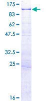 SDS-PAGE: Recombinant Human CENPC GST (N-Term) Protein [H00001060-P01]