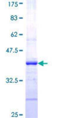 SDS-PAGE: Recombinant Human CFTR GST (N-Term) Protein [H00001080-Q01]