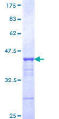 SDS-PAGE: Recombinant Human CHD3 GST (N-Term) Protein [H00001107-Q01]