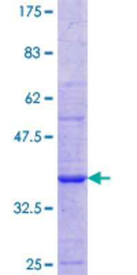 SDS-PAGE: Recombinant Human Nicotinic Acetylcholine R alpha 1/CHRNA1 GST (N-Term) Protein [H00001134-Q01]