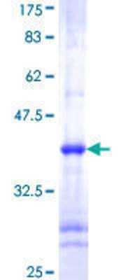 SDS-PAGE: Recombinant Human IKK alpha GST (N-Term) Protein [H00001147-Q01]