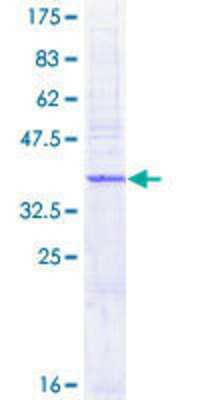 SDS-PAGE: Recombinant Human AP1S1 GST (N-Term) Protein [H00001174-P01]