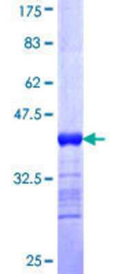 SDS-PAGE: Recombinant Human CLCA1 GST (N-Term) Protein [H00001179-Q01]