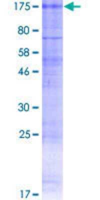 SDS-PAGE: Recombinant Human CLCN1 GST (N-Term) Protein [H00001180-P01]